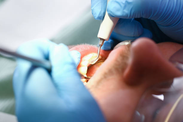 Best Tooth Pain Emergency Relief  in Port Huron, MI